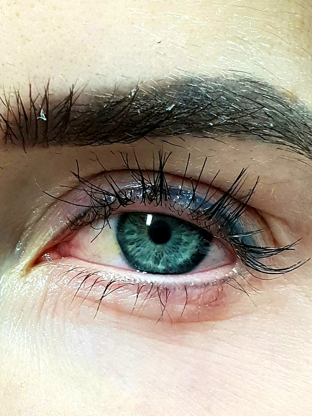 In-Liner